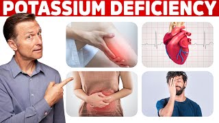 Low Potassium Signs Symptoms Causes and Treatment [upl. by Enneira371]