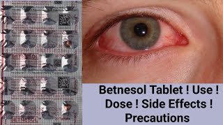 Betnesol Tablet  Betamethasone  Use  Dose  Side Effects  Precautions [upl. by Hwang]