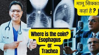 coin in chest Xray Trachea or Esophagus radiology ENTneet [upl. by Ainomar]