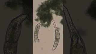 Rotifers Feeding [upl. by Yla]