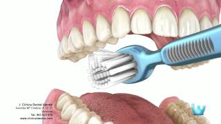 Higiene dental  Clinica identis [upl. by Leelah]