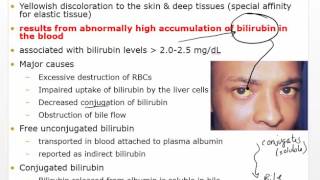 Chapter 30 Video Disorders of Hepatobiliary Liver and Pancreatic [upl. by Gal392]