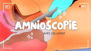 Amnioscopie [upl. by Yrehc]