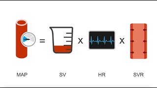 Differentiating cardiogenic shock from other types of shock [upl. by Eadnus]