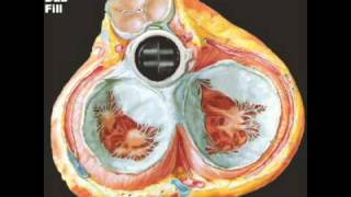 Animated Mechanical Aortic Valve [upl. by Nasah663]