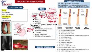 Fracturas Generalidades  Ortopedia y Traumatología Clases Qx Medic  01 [upl. by Val]