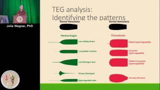 The Whole Picture Interpretation of TEG Tracings Coagulation factors  platelets Julie Wegner PhD [upl. by Carolyn]