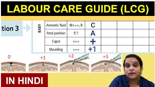 WHO Labour Care Guide in Hindi  LCG Guidelines  Nursing Lecture [upl. by Ednargel]