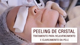 Peeling de Cristal tratamento para rejuvenescimento e clareamento da pele [upl. by Carina]