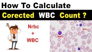 Corrected WBC Count  Clear Explain [upl. by Aivull]