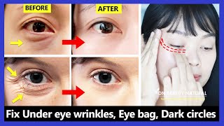 Only 6 mins Eye rejuvenation Get rid of under eye wrinkles dark circles eye bags Crows feet [upl. by Goat]