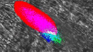 Thrombus Formation in Real Time [upl. by Gaul]