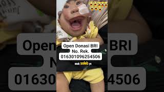 BAYI AJAIB BAYI VIRAL BAYI ANUGRAH BAYI TERLAHIR TANPA TEMPURUNG KEPALA SUBHANALLAH KUASA ALLAH SWT [upl. by Hgielram145]