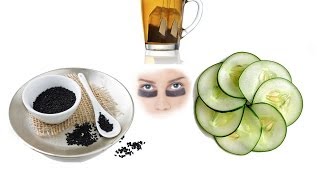 Home Remedies for Dark Circles Under Eyes [upl. by Ainatnas]