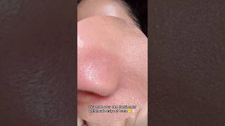 Remove blackheads amp whiteheads at home🫢👃🏻💯shorts [upl. by Tobin229]