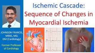 Ischemic cascade Sequence of changes in myocardial ischemia [upl. by Tesler351]