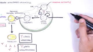 ANCA Associated Vasculitis AntiNeutrophil Cytoplasmic Antibody  Causes Pathophysiology Types [upl. by Yllier567]