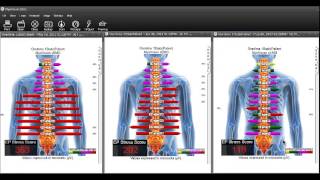 What is The EP Stress Score [upl. by Crenshaw]