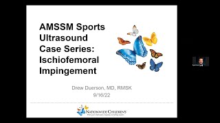 Ischiofemoral Impingement with Dr Drew Duerson  AMSSM Sports Ultrasound Case Presentation [upl. by Gaul41]