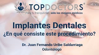 Implantes Dentales ¿En qué consiste este procedimiento [upl. by Ethbin332]