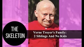 Verne Troyers Family 2 Siblings And No Kids [upl. by Durno651]