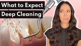 What To Expect From a DEEP Cleaning at the Dentist [upl. by Mossolb]