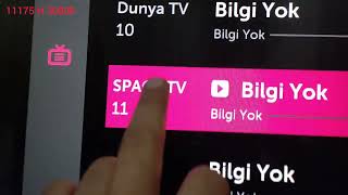 LG TV kanal yığılma qaydası smart TV onlayn xidmət göstərilir online xidmet994506469035 [upl. by Annoiek]