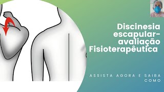 Discinesia escapular  avaliação Fisioterapêutica [upl. by Aikam]