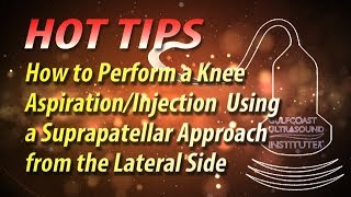 How to Perform a Knee Aspiration and Injection Using a Suprapatellar Approach [upl. by Hairym]