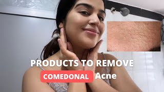 Products to remove Comedonal Acne  Skincare products to remove Whiteheads acne [upl. by Zednanref935]