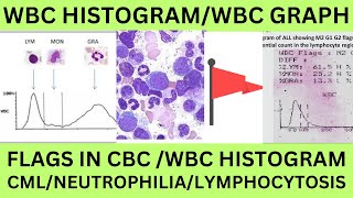 WBC HISTOGRAM FOR STUDENTSWLWUT1T2F1F2 F3AG FLAGS IN WBC HISTOGRAM WBC GRAPH IN CBC PRINT [upl. by Heimer52]