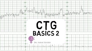 CTG Basics Part 2  Decelerations amp Fetal Physiology [upl. by Ney]