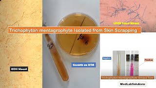 Trichophyton mentagrophyte isolated from clinical sample Skin Scrapping [upl. by Intihw]