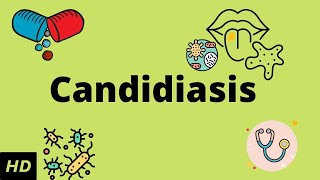 CANDIDIASIS Causes Signs and Symptoms Diagnosis and Treatment [upl. by Melany]