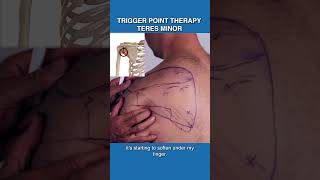 Releasing Teres Minor Trigger Points [upl. by Sparhawk]