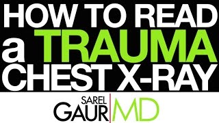 How to Read a Trauma Chest Xray in 3 Minutes [upl. by Brennan]