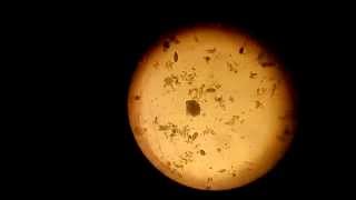 Rumen protozoal activity in cattle [upl. by Anitnerolf562]