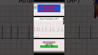 Atrial Fibrillation Causes Symptoms and Treatments  Explained by a Medical Professional [upl. by Enahpets]