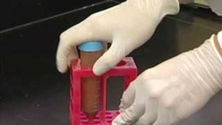 Video 6  DNA Extraction part 1 [upl. by Ahseim]