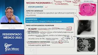 Neumología  12 MICOSIS PULMONARES [upl. by Emmit]