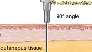 Practicaltypes of injectionscience magic ytshorts viralvideo experiment subscribe ds wallah [upl. by O'Meara714]