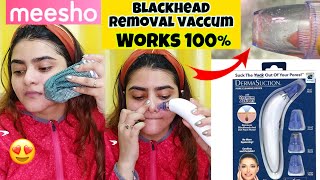 MEESHO Blackhead Remover Machine  How to remove BLACKHEADS  Works 100  meesho meeshohaul [upl. by Lillywhite580]