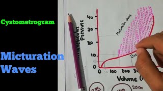 Cystometrogram  Micturition waves  Renal system 46 [upl. by Demetrius]