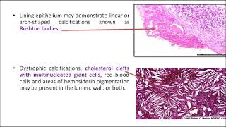 ORALPATH CHAP3 PART2 ODONTOGENIC CYSTS AND TUMOURSENGLISH [upl. by Keefe]