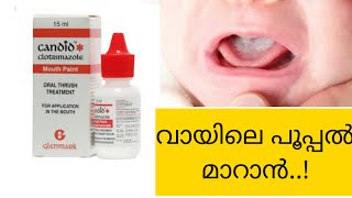 Clotrimazole mouth paint Malayalam review  candid mouth paint  വായിലെ പൂപ്പൽ മാറാൻ  antifungal [upl. by Daub]