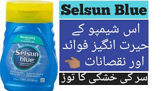 Selsun Blue Dandruff Shampoo Honest ReviewBest Dandruff Shampoo in PakistanDandruff Treatment [upl. by Khai]