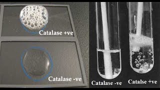 Catalase Test [upl. by Juliana]