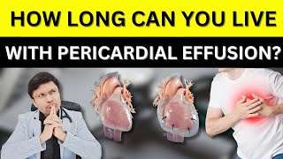 Pericardial Effusion Causes Symptoms Diagnosis amp Treatment PERICARDIALEFFUSION [upl. by Fauman944]