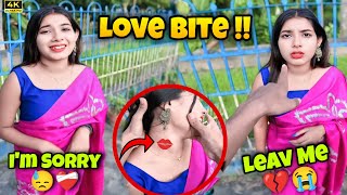 Kissing Prank Gone Wrong💔 Found Love Bite💋🤬Ankur000 [upl. by Aymik]