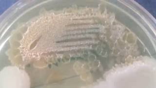 Moraxella lacunata  Pitted colonies [upl. by Enyehc]